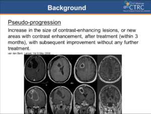 delayed-contrast-extravasation-mri-for-depicting-tumor-and-non-tumoral-tissues