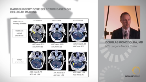 radiosurgery-dose-selection-based-on-cellular-imaging