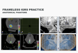 Frameless IGRS Requirements: 6D Positioning and Monitoring