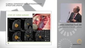 Clinical Experience with Intraoperative Structure Update