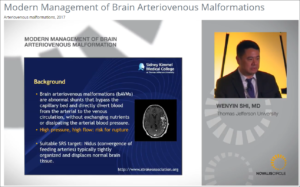 Modern Management of Brain Arteriovenous Malformations