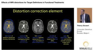 effects-of-mri-distortions-for-target-definitions-in-functional-treatments