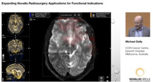 expanding-novalis-radiosurgery-applications-for-functional-indications