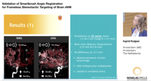 Validation of Smartbrush Angio Registration for Frameless Stereotactic Targeting of Brain AVM