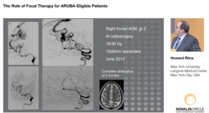 The Role of Focal Therapy for ARUBA-Eligible Patients