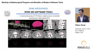 starting-a-radiosurgery-program-and-benefits-of-modern-software-tools