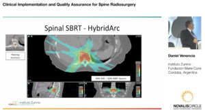clinical-implementation-and-quality-assurance-for-spine-radiosurgery