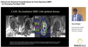 Clinical and Technical Considerations for Post-Operative SBRT - An Emerging Paradigm Shift