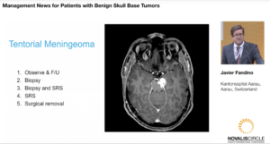 management-news-for-patients-with-benign-skull-base-tumors