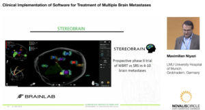 clinical-implementation-of-software-for-treatment-of-multiple-brain-metastases