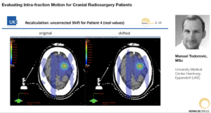 evaluating-intra-fraction-motion-for-cranial-radiosurgery-patients