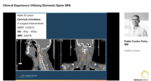 clinical-experience-utilizing-elements-spine-srs