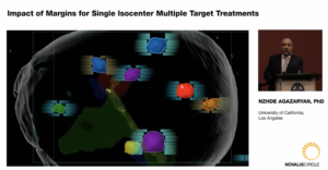 impact-of-margins-for-single-isocenter-multiple-target-treatments