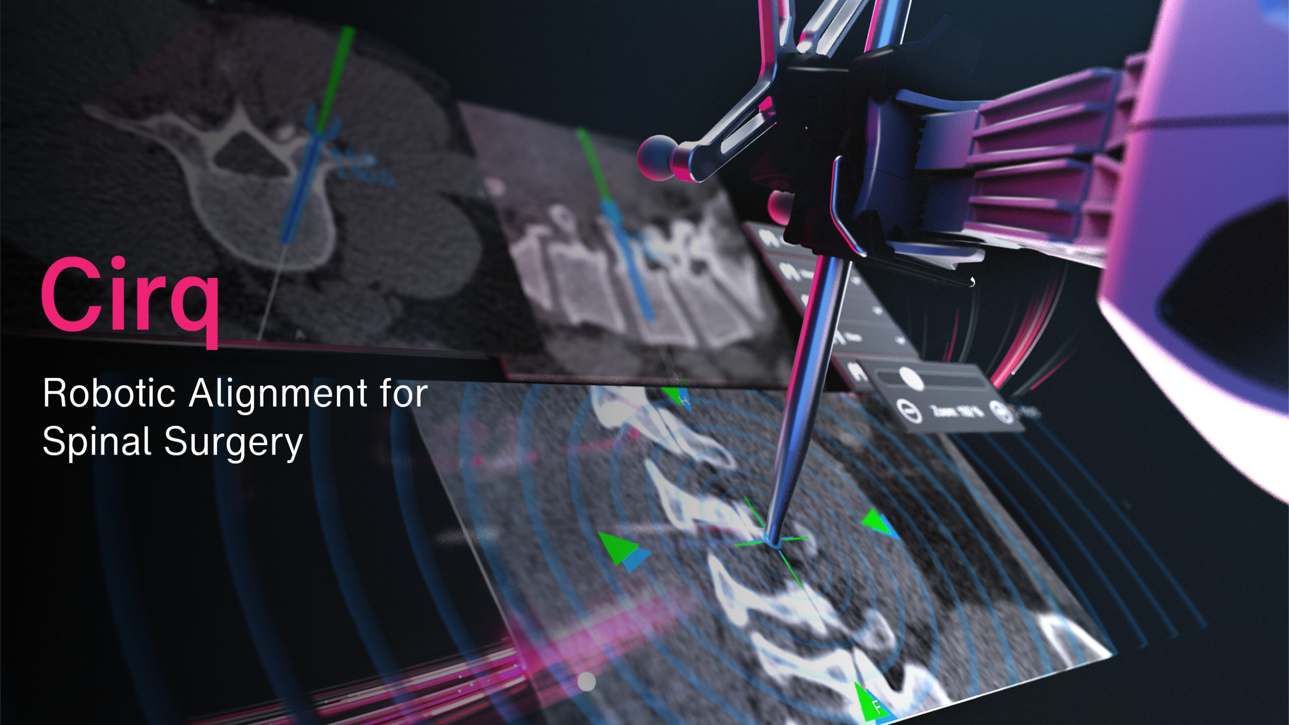 Brainlab Video Cirq Robotic Alignment for Spinal Surgery
