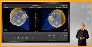 Cranial setup and treatment monitoring ETD 1.0