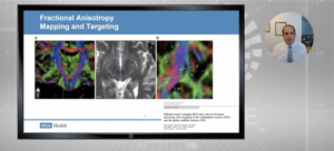 safe-neuroablation-via-advanced-image-processing-tools