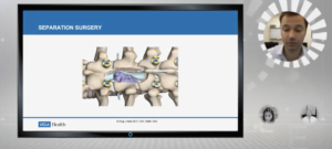 Case of the Month Webinar: Separation Surgery + Radiosurgery for Spine Metastasis Patient