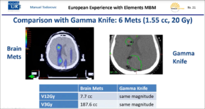 european-experience-with-elements-multiple-brain-mets-srs