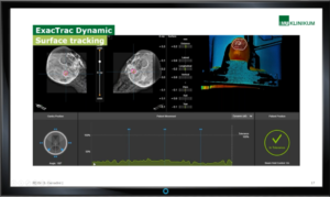 clinical-versatility-of-exactrac-dynamic