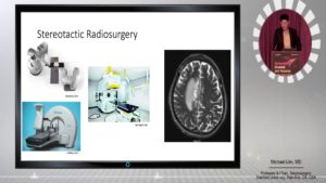 Building a successful radiosurgery program