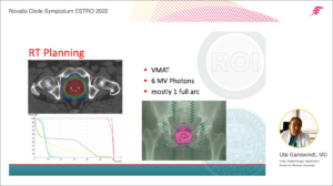 Prostate Cancer Radiotherapy Practice Review