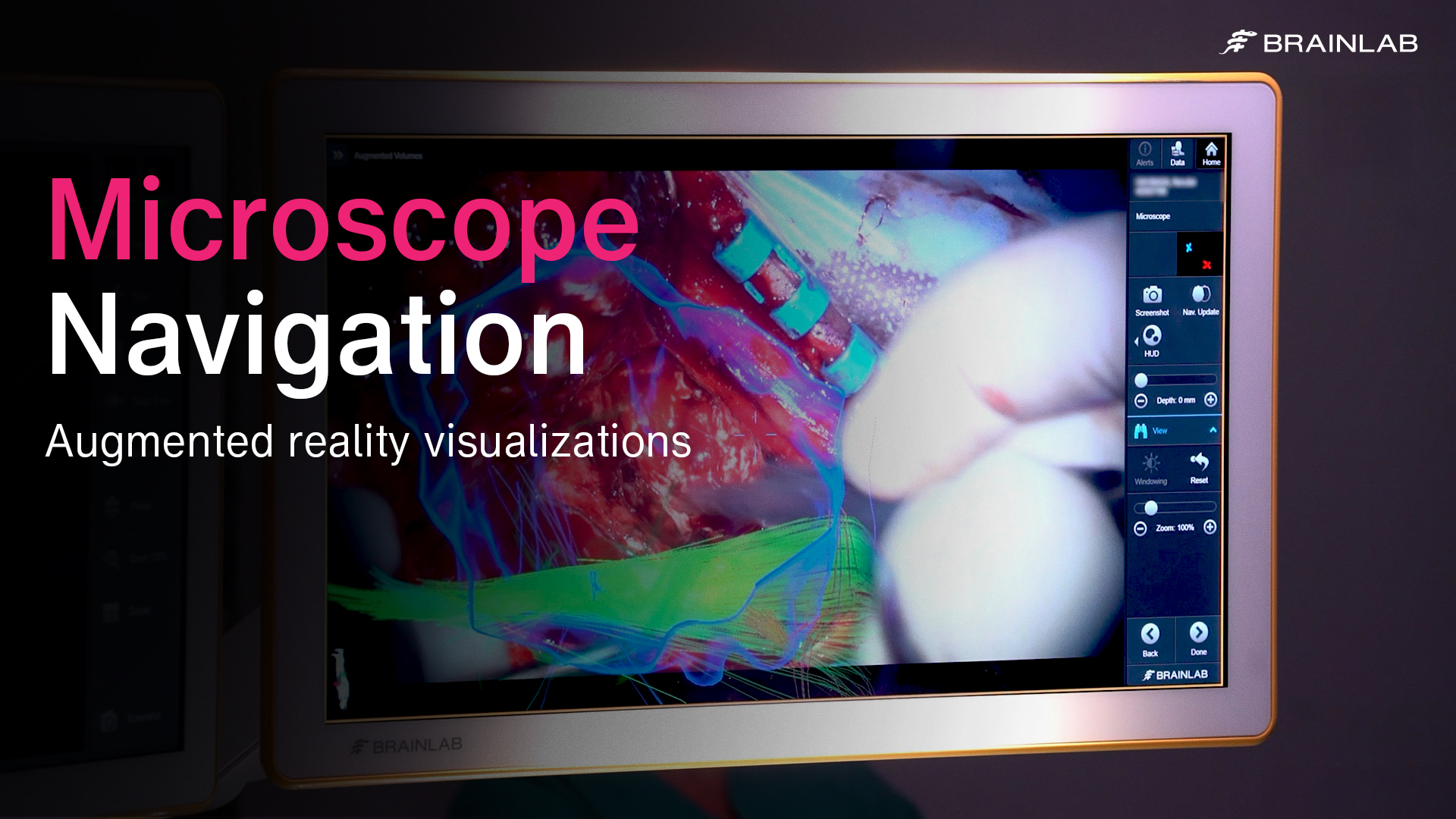 マイクロスコープナビゲーション：脳神経外科手術に求められる精度を