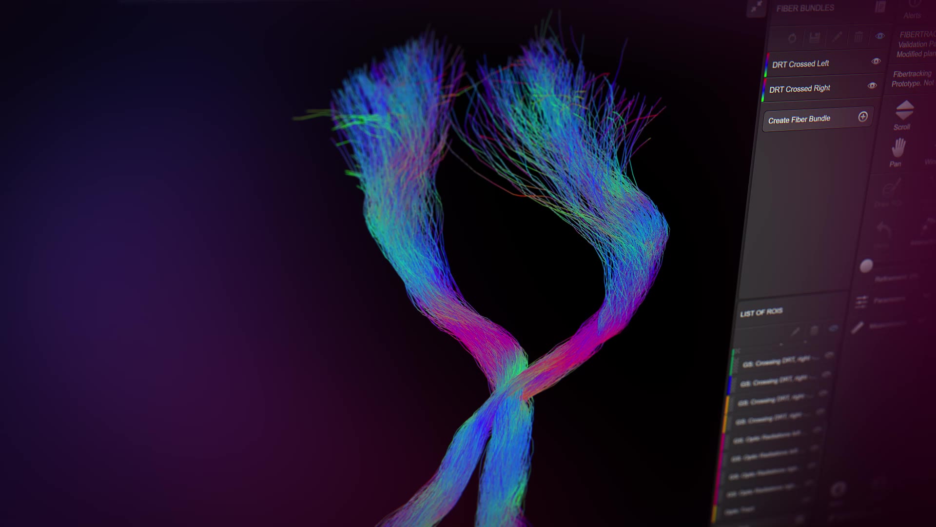 elements-fibertracking-for-functional-neurosurgery-mp4