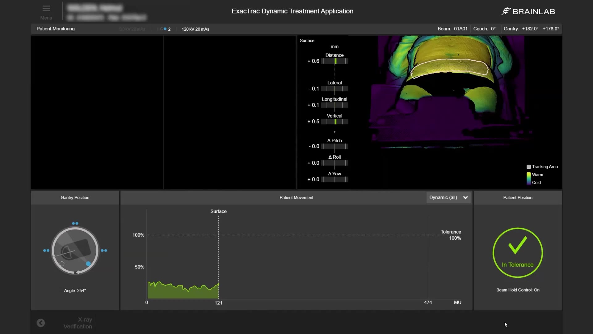 etd-prostate-feature-automatic-beam-hold-for-treatment-safety-mp4