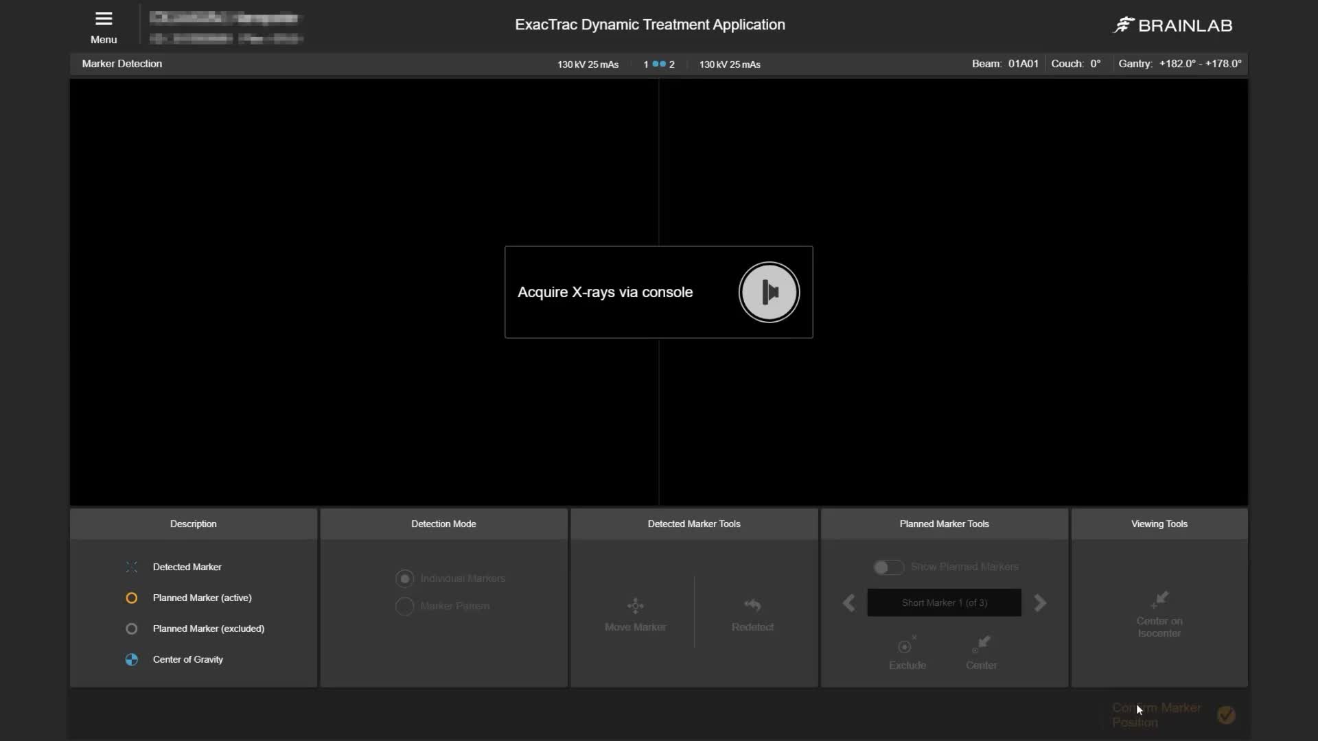 etd-prostate-feature-automatic-marker-detection-mp4