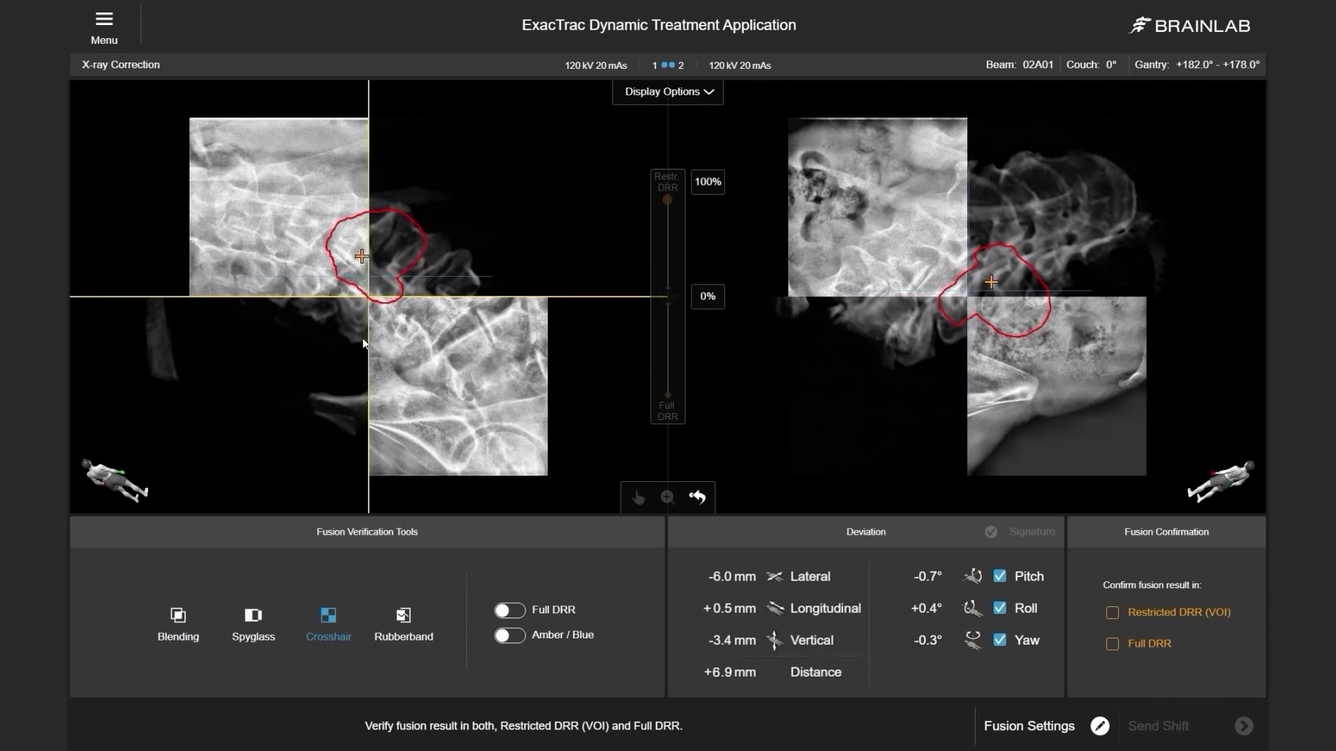 large-field-of-view-at-isocenter-mp4