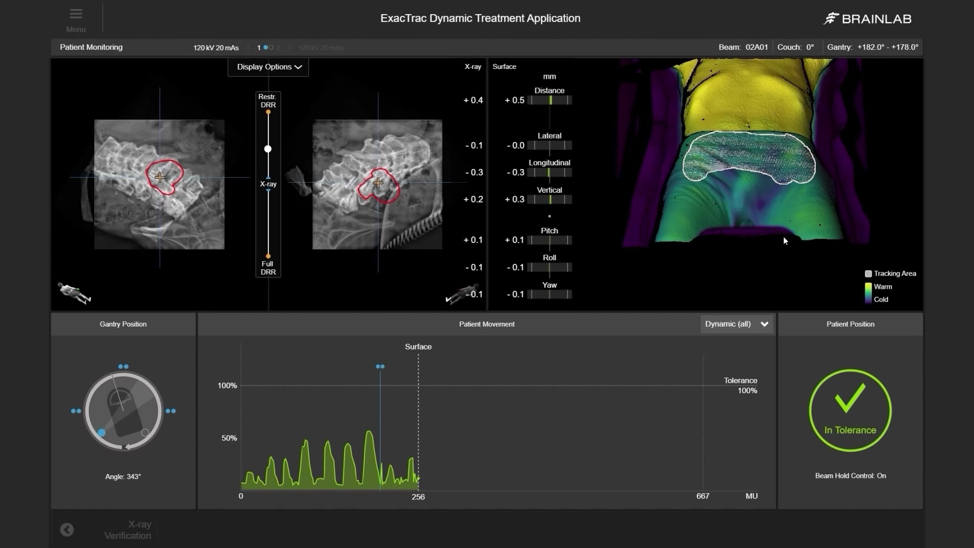 deep-linac-integration-and-interoperability-mp4