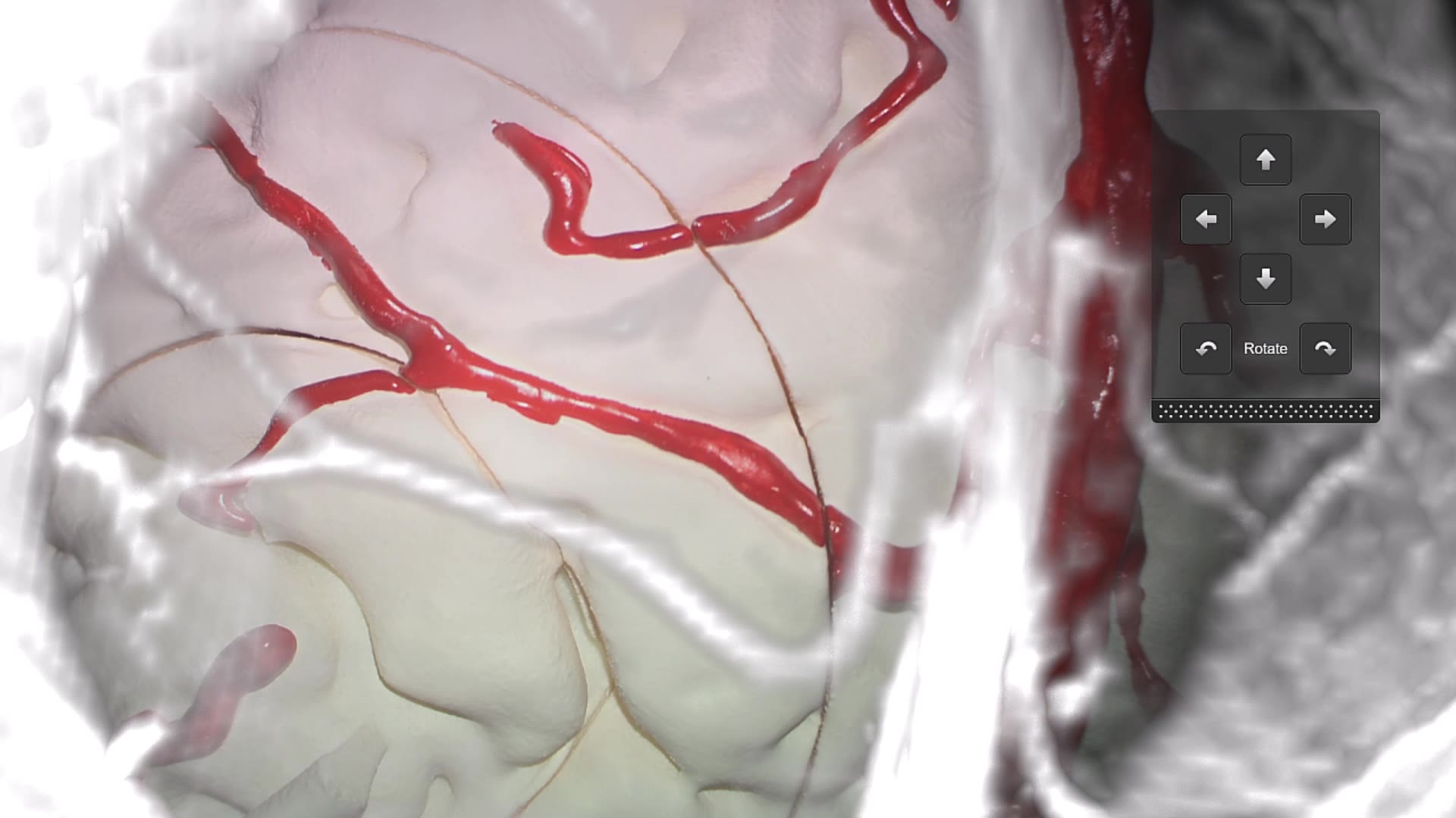 cranial-microscope-navigation-feature-3-navigation-update-mp4
