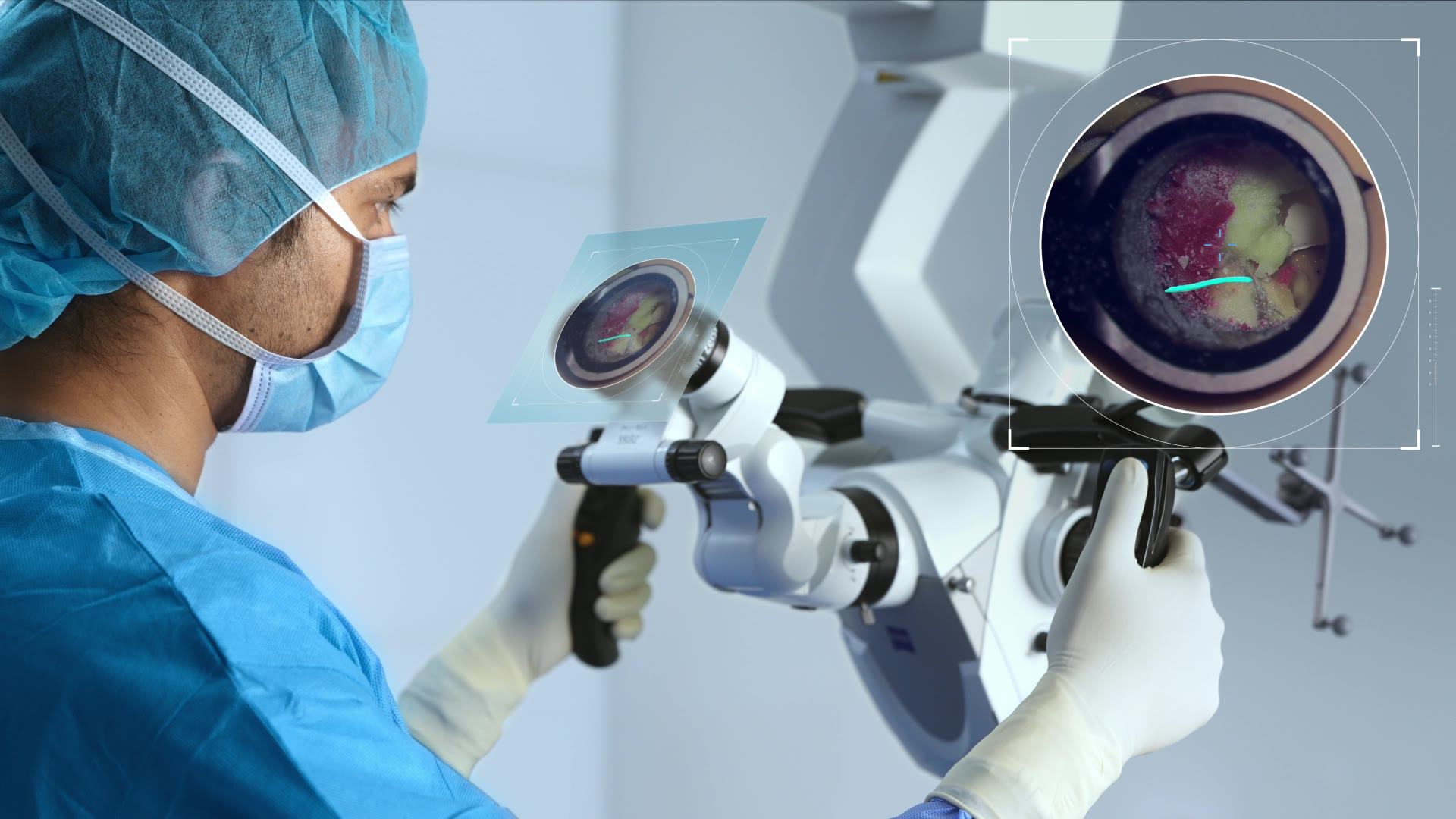 spine-microscope-navigation-feature-3-misworkflow-mp4