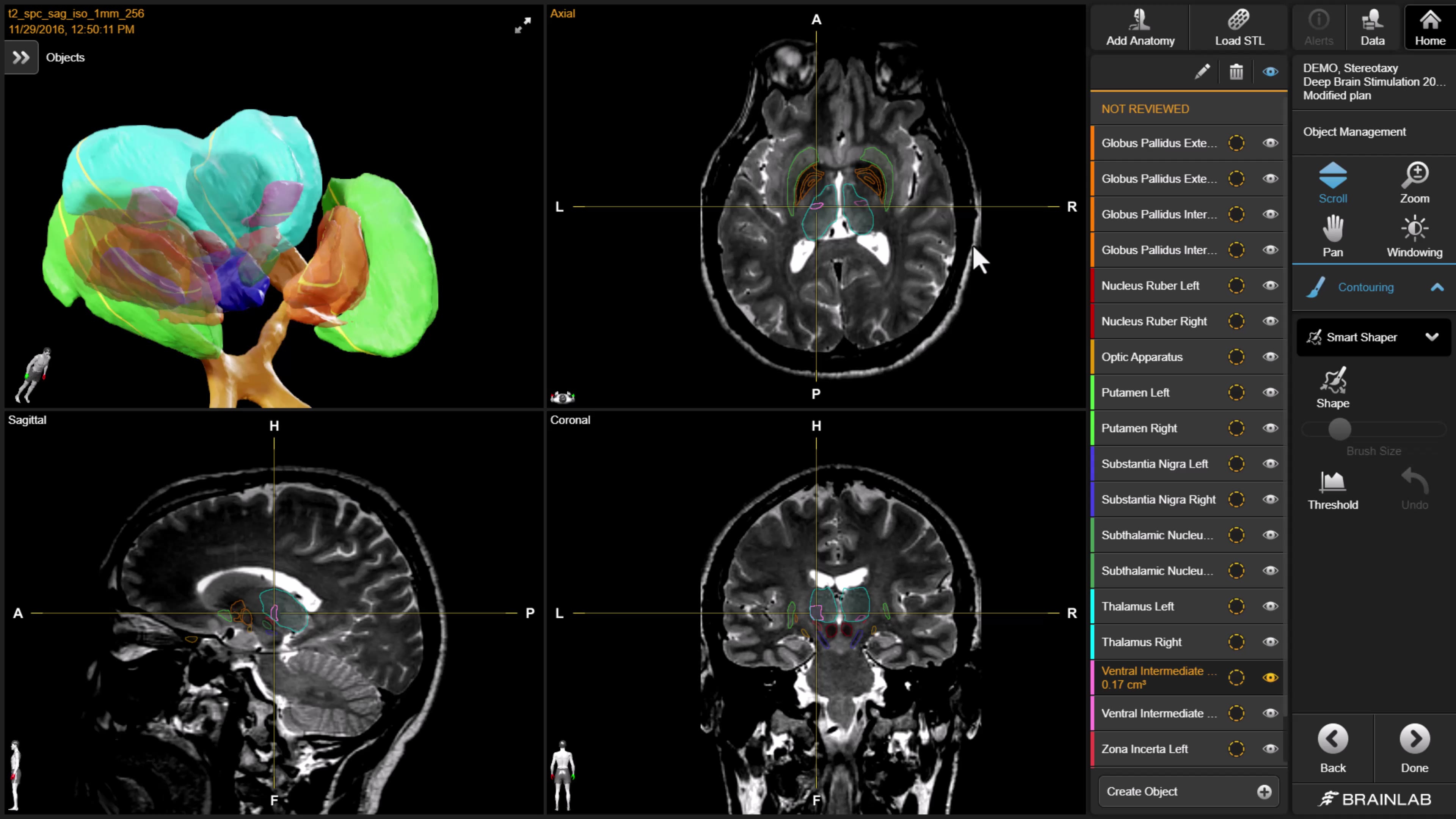 fsn-planning-patient-anatomy-segmentation-background-mp4