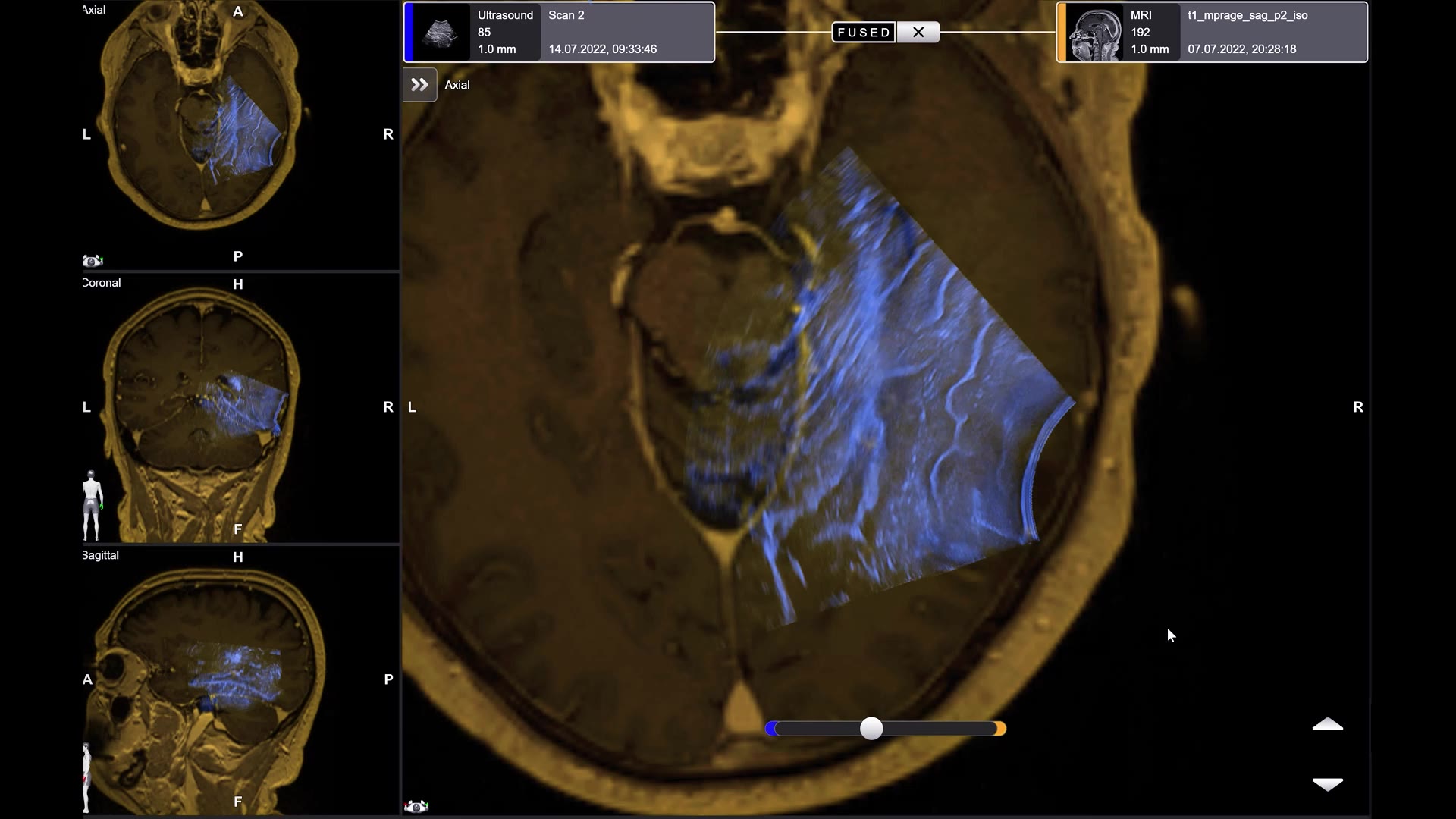 ultrasound-navigation-screen-recording-background-mp4